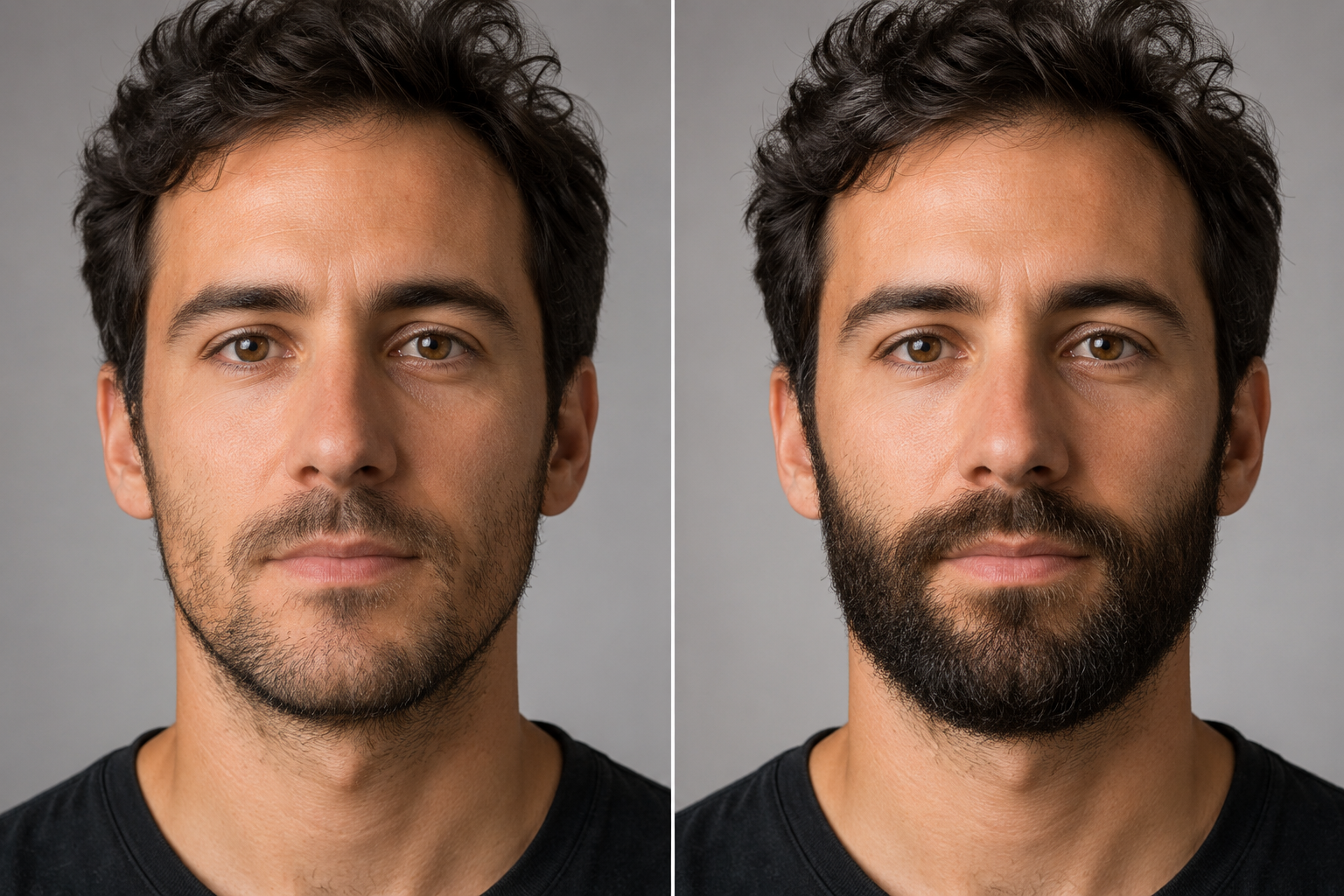Barba Plus – Risultati prima e dopo